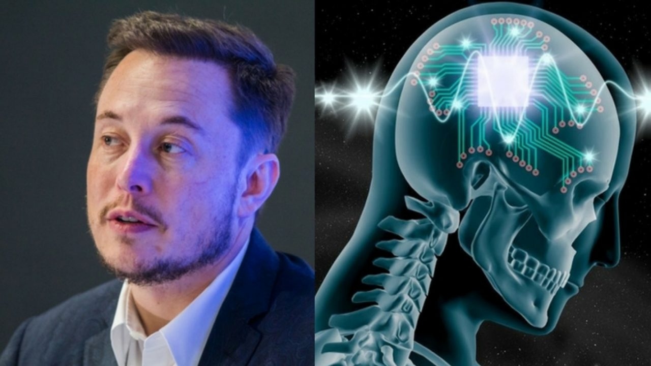 Instalan chip cerebral en primer paciente humano