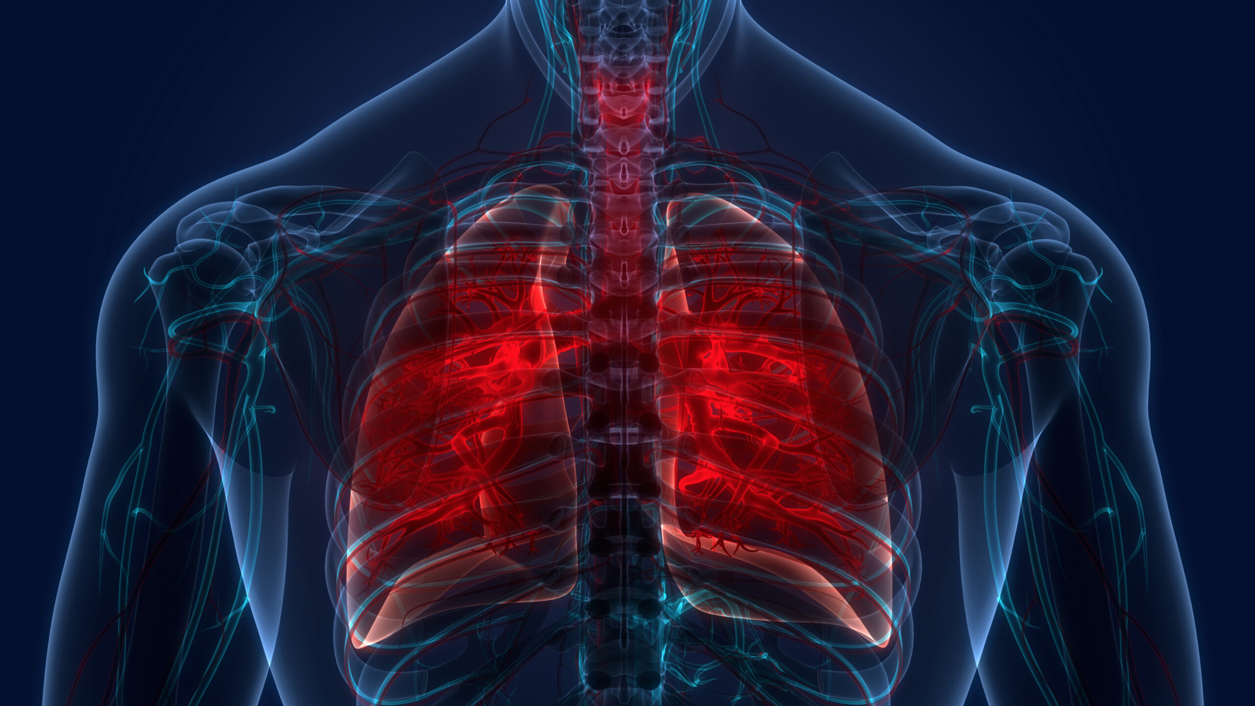 OMS: Millones de vidas peligran por tuberculosis tras cese de ayuda de EEUU