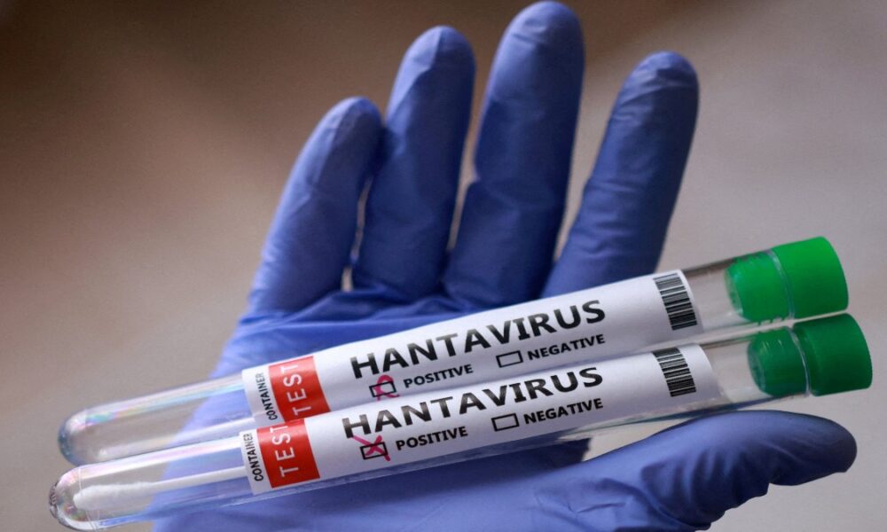 OMS : hantavirus es altamente contagioso en fase inicial