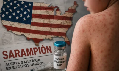 Crisis sanitaria: EEUU supera los 3.800 casos de sarampión
